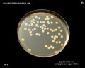 e.coli tryptis soy agar